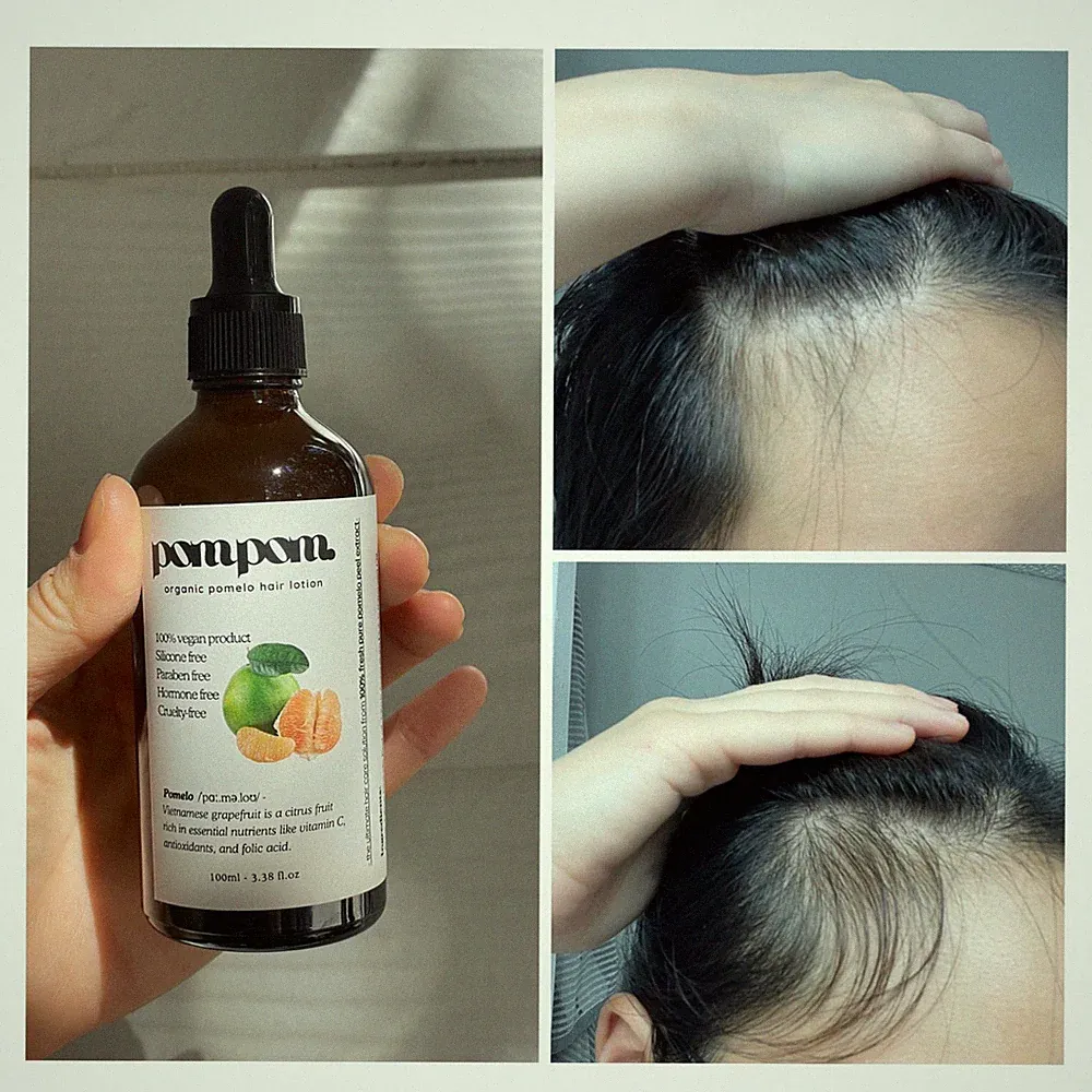 PomPomHairUSA - Hair Growth Fresh Pomelo Tonic No Greasy and 100% Chemical Free